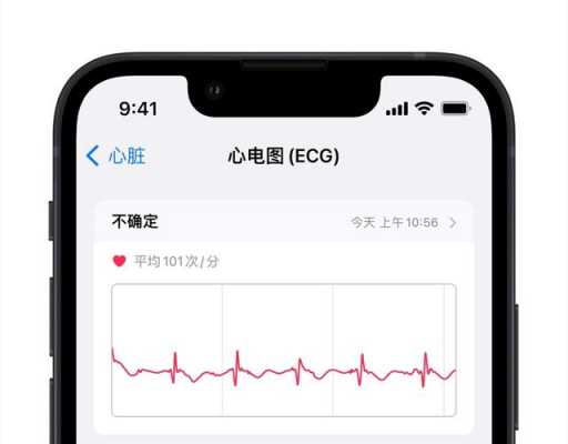 iphone用心电图手机要什么系统（苹果心电图什么时候上线）